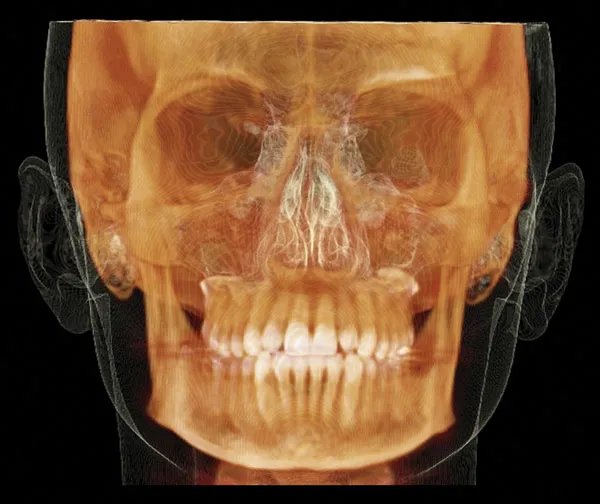 3D imaging can provide more insight into your case