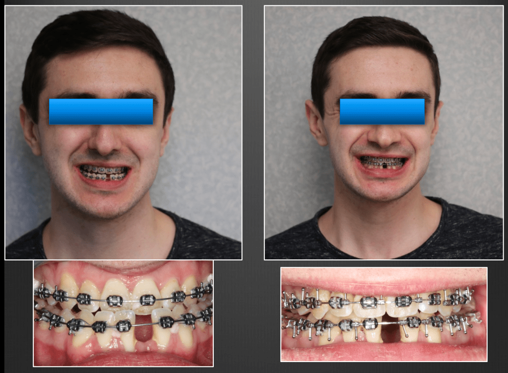 smile gallery