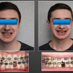 smile gallery